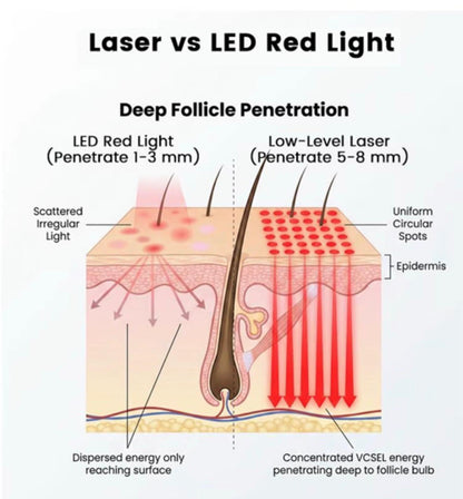 NeoSpark™ Red Light Laser Hair Growth Helmet